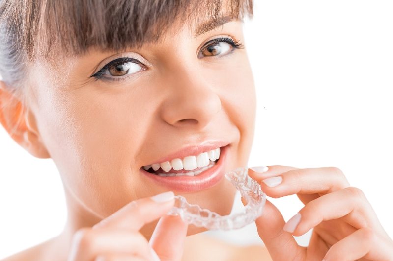 Why Choose Clear Aligners?